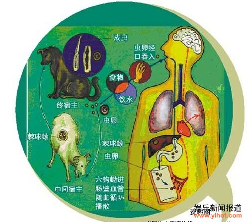 寄生虫